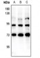 Anti-FOXO1/3 (pS322+S325/pS318+S321) Antibody