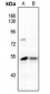 Anti-JNK1/2/3 (pY185) Antibody