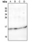 Anti-NDUFC2 Antibody