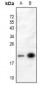 Anti-p19 INK4d Antibody