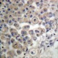 Anti-PLC beta 3 Antibody