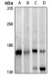 Anti-PLC beta 3 Antibody