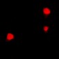 Anti-ZNF23 Antibody