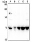 Anti-ZNF23 Antibody