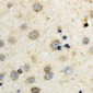 Anti-Adenylate Cyclase 7 Antibody