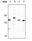 Anti-Adenylate Cyclase 7 Antibody