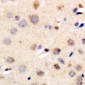 Anti-R Cadherin Antibody