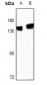 Anti-R Cadherin Antibody