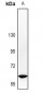 Anti-SHCC Antibody