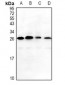 Anti-MAGEA5 Antibody