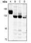 Anti-Collagen 17 alpha 1 Antibody