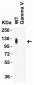 SARS-CoV-2 (COVID-19) Spike 26P Antibody [1C3H9]