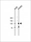 RASGRP1 Antibody (Center)