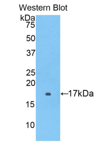 Polyclonal Antibody to Protease Activated Receptor 2 (PAR2)