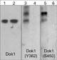 Anti-Dok1 (Tyr-362) [Dok2 (Tyr-337)], Phosphospecific Antibody