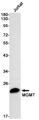 MGMT Rabbit mAb