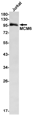 MCM6 Rabbit mAb