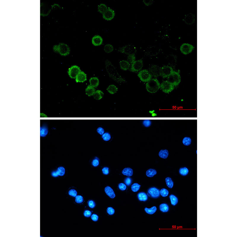 E Cadherin Rabbit mAb