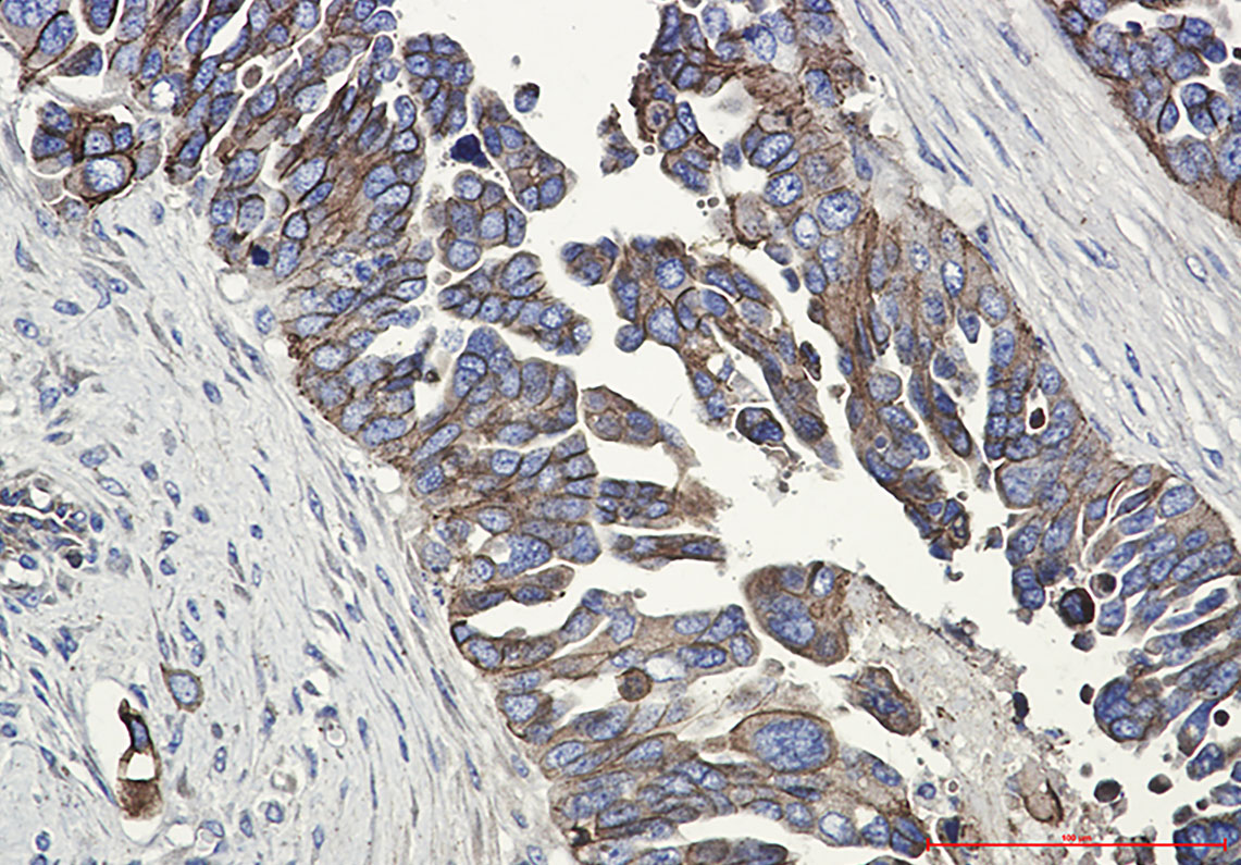 E Cadherin Rabbit mAb