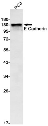 E Cadherin Rabbit mAb