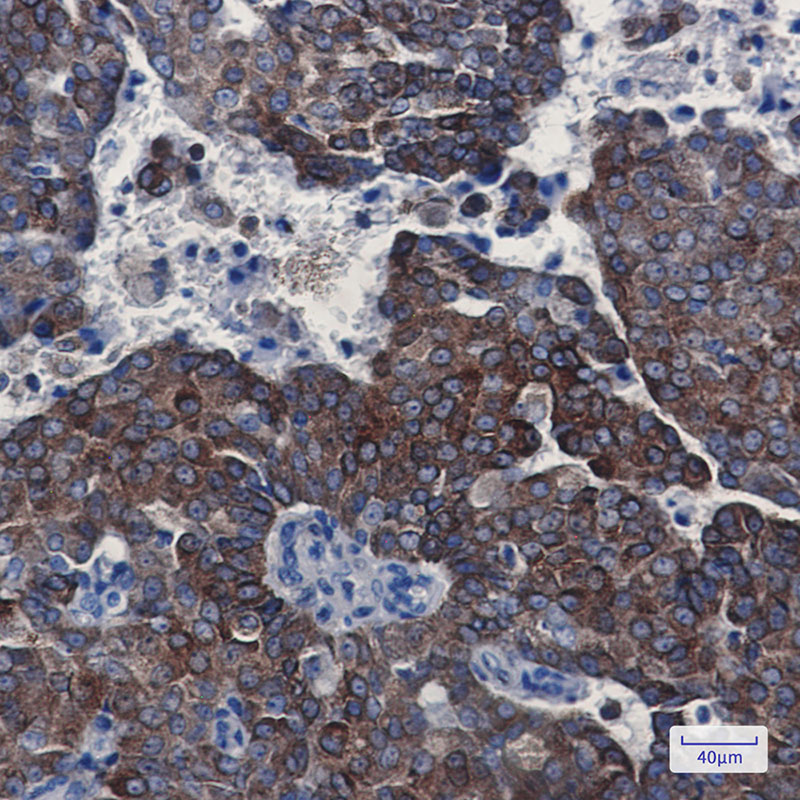 Bcl2 Rabbit mAb