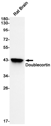 Doublecortin Rabbit mAb