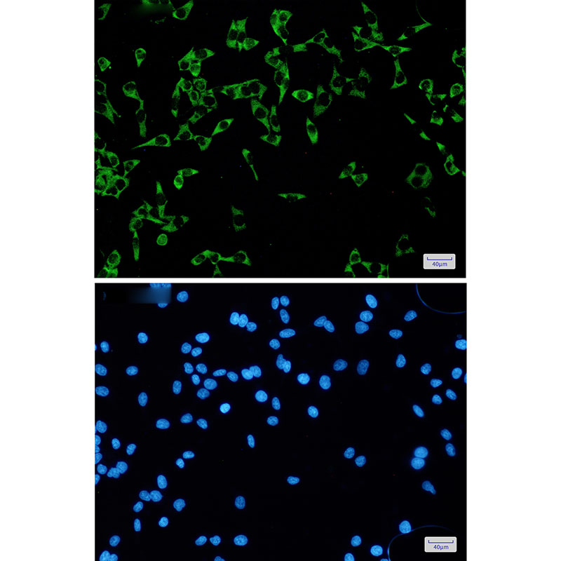 FMRP Rabbit mAb