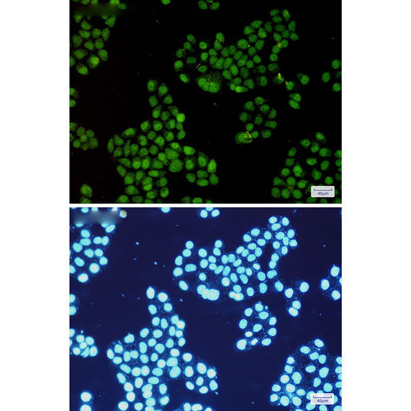 CDK2 Rabbit mAb