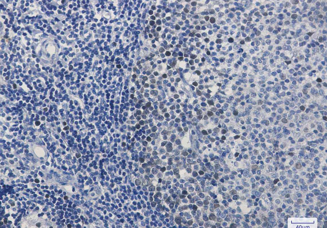 CDK2 Rabbit mAb