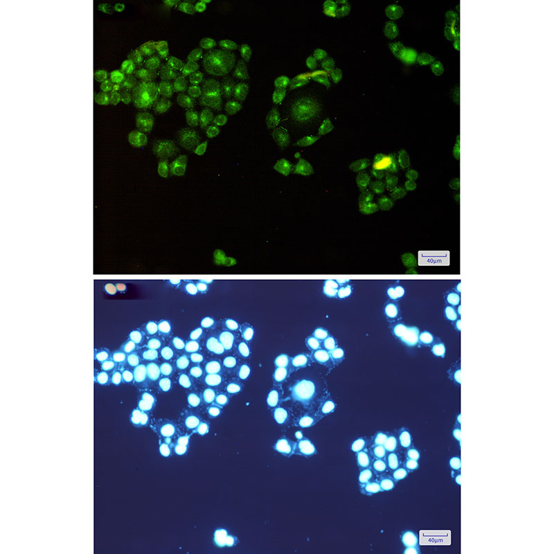 Rab8A Rabbit mAb