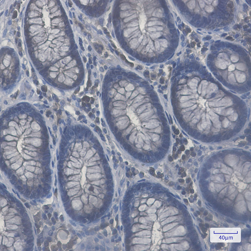 Rab8A Rabbit mAb