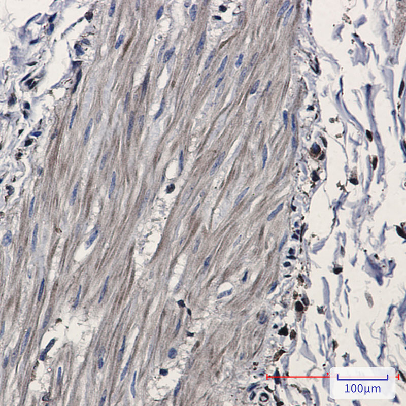 IDH1 Rabbit mAb