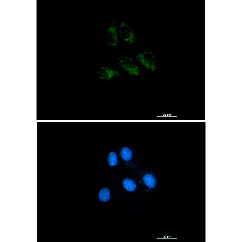 Thrombomodulin Rabbit mAb