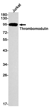 Thrombomodulin Rabbit mAb