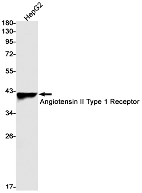 Angiotensin II Type 1 Receptor Rabbit mAb