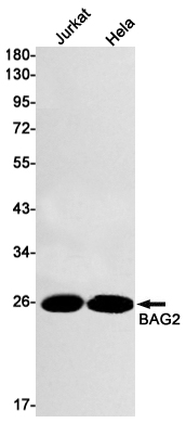 BAG2 Rabbit mAb