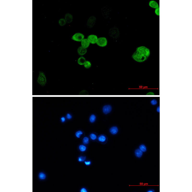 CRABP2 Rabbit mAb