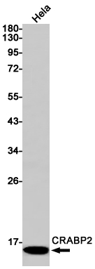 CRABP2 Rabbit mAb