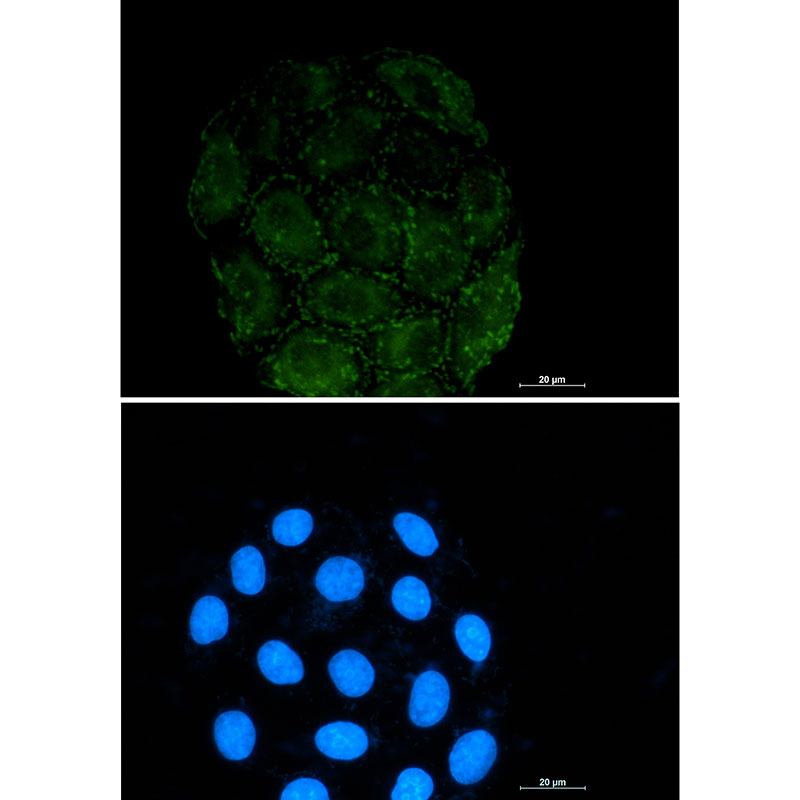 Integrin alpha V Rabbit mAb