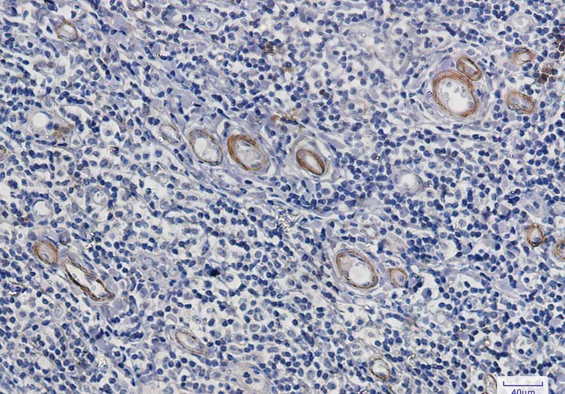 Asparagine Synthetase Rabbit mAb