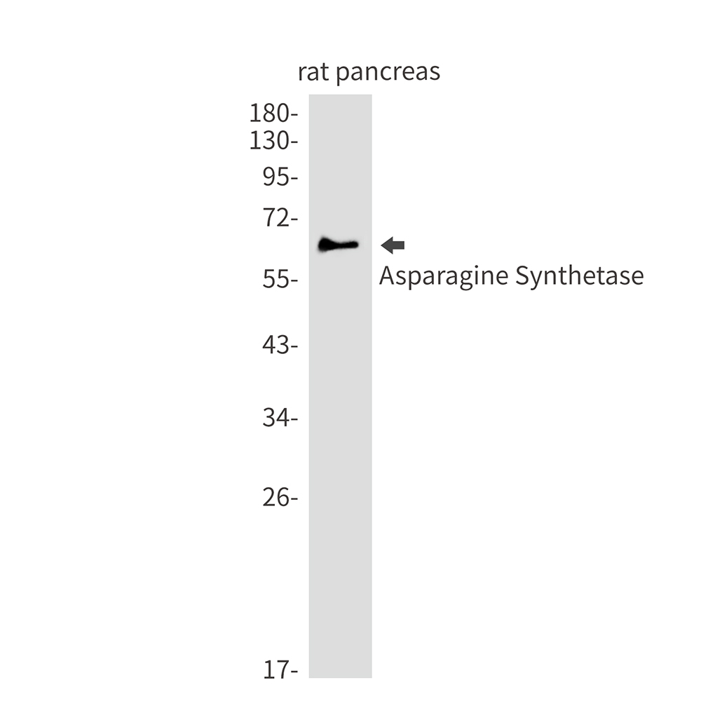 Asparagine Synthetase Rabbit mAb