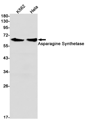 Asparagine Synthetase Rabbit mAb