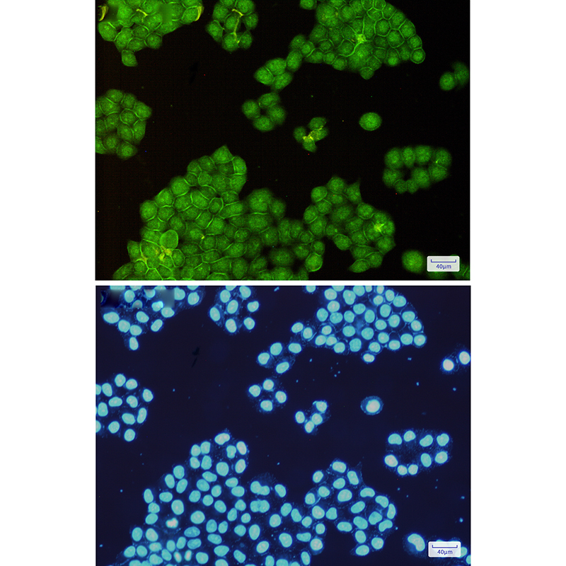 Annexin VI Rabbit mAb