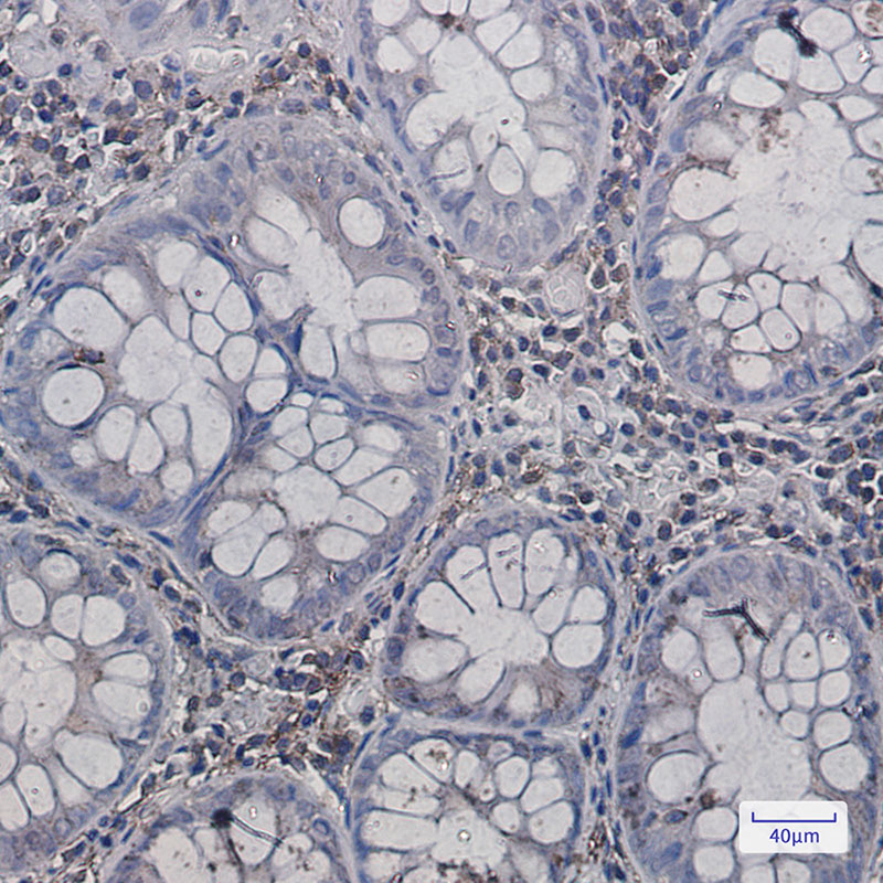 Annexin VI Rabbit mAb