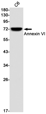 Annexin VI Rabbit mAb