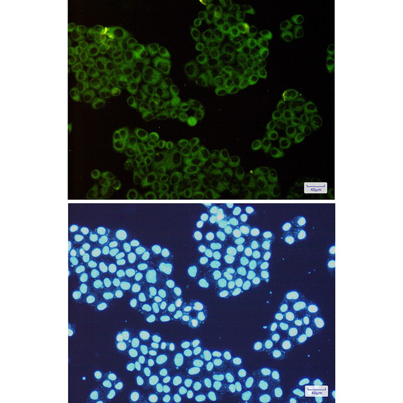 ROCK2 Rabbit mAb