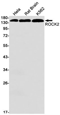 ROCK2 Rabbit mAb