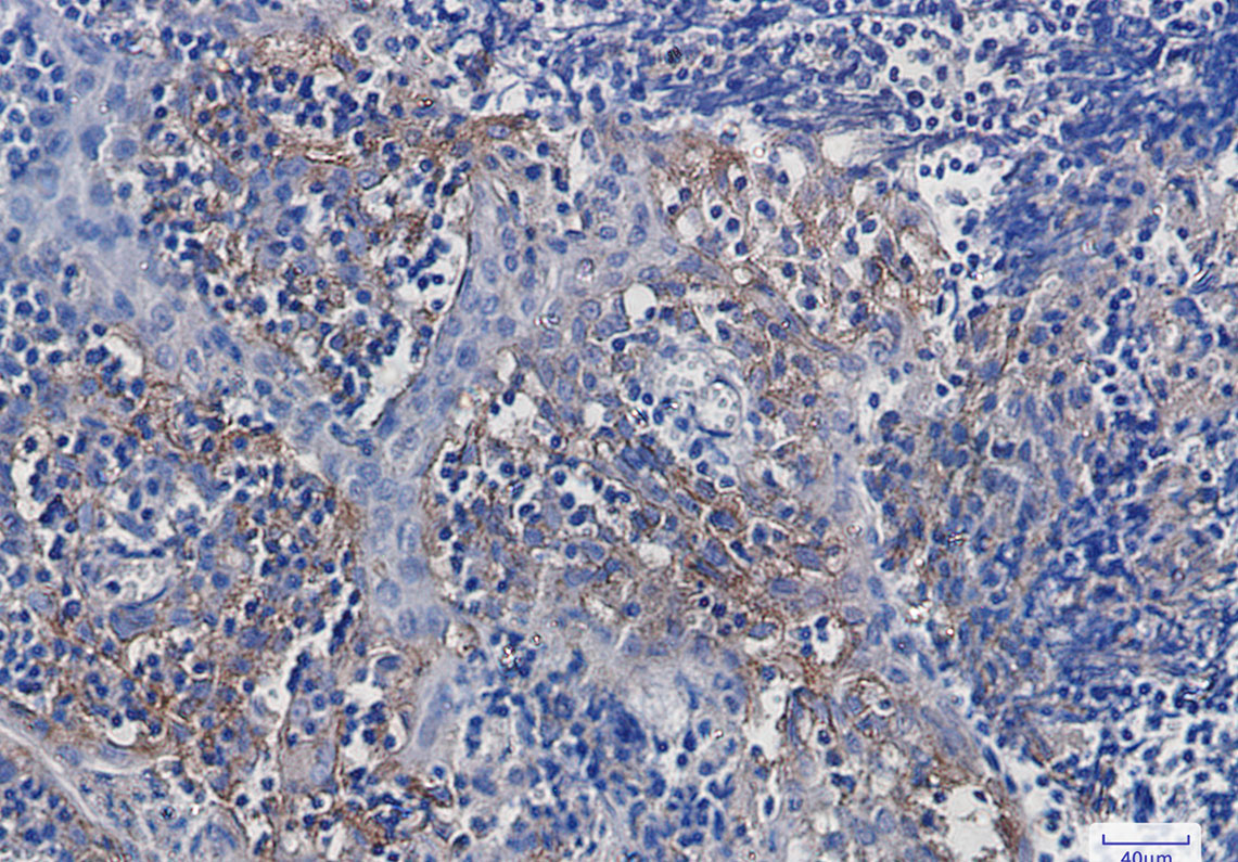 Integrin alpha V Rabbit mAb