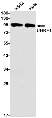 UHRF1 Rabbit mAb