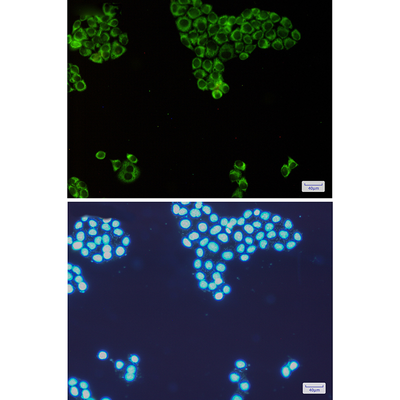 PKR Rabbit mAb